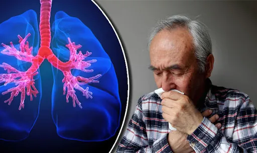Bệnh phổi tắc nghẽn mãn tính hiện chưa thể chữa khỏi hoàn toàn
